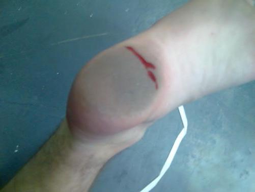 post-3895-1203049899_thumb.jpg